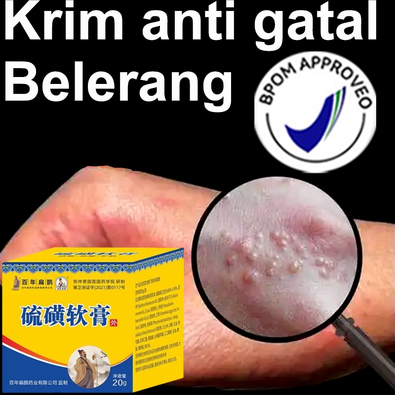 Salep gatal belerang asli original 100% Salep belerang untuk gatal 20g kulit gatal kering, alergi ga