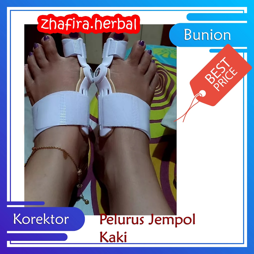 Alat korektor pelurus jempol kaki penyangga tulang jempol jari kaki bunion terapi alat  pelurus jemp