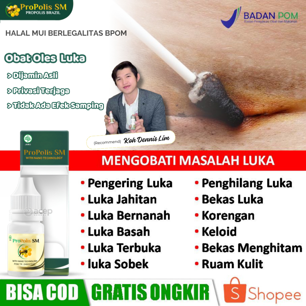 Obat Pengering Luka Jahitan, Bekas Operasi Sesar, Penghilang Luka Di Wajah, Kaki, Korengan, Keloid, 