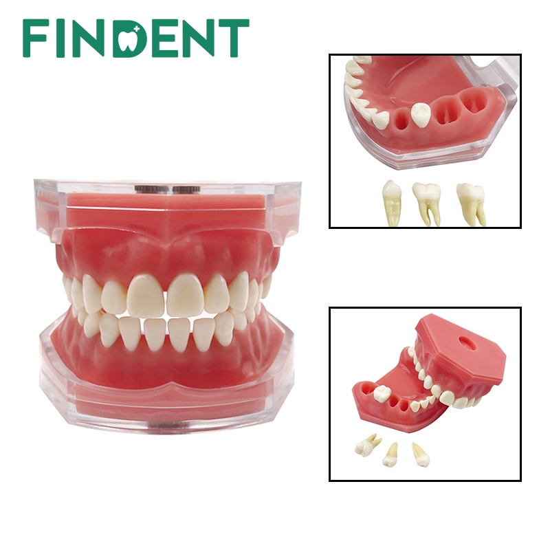 Dental study model typodont gigi bisa dilepas phantom studi edukasi gusi karet soft rubber gingiva
