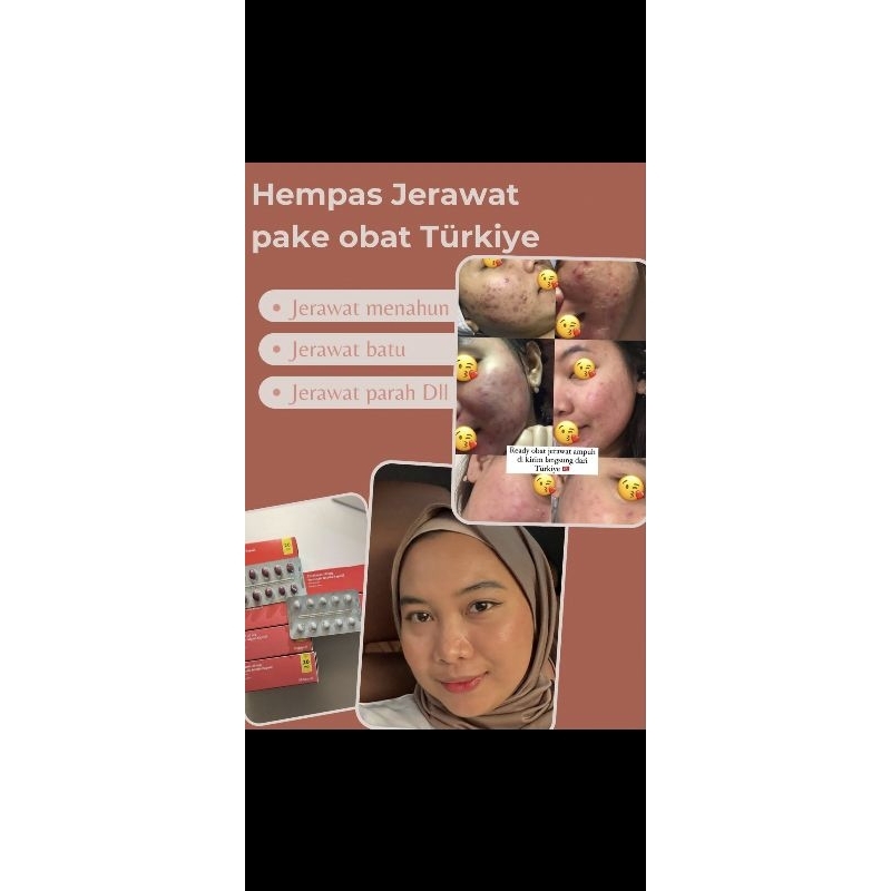 

linkpaymentobat j3r4wat Maximal beli 1