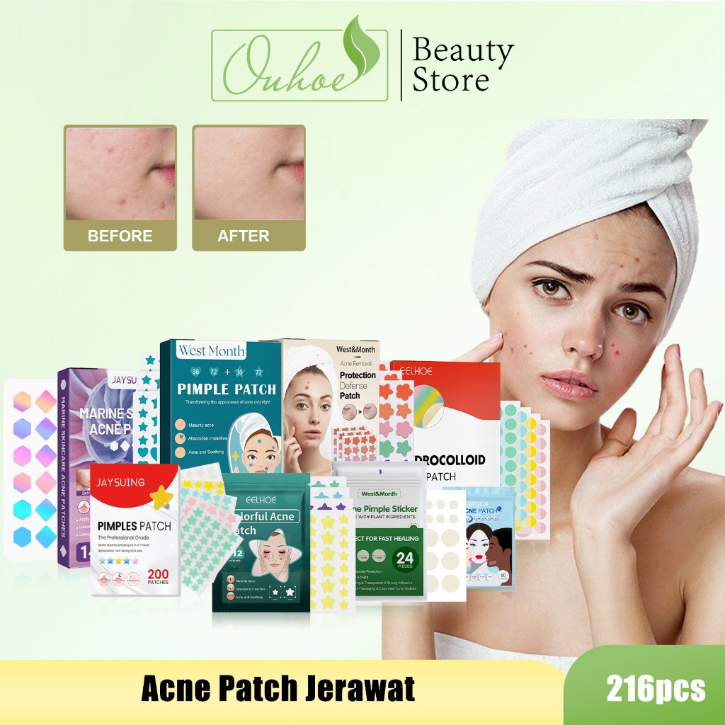 [Ready/Beli 2 gratis 1] Acne Patch Acne Patch Jerawat Acne Patch Jerawat Lucu Acne Patch Hologram Ac