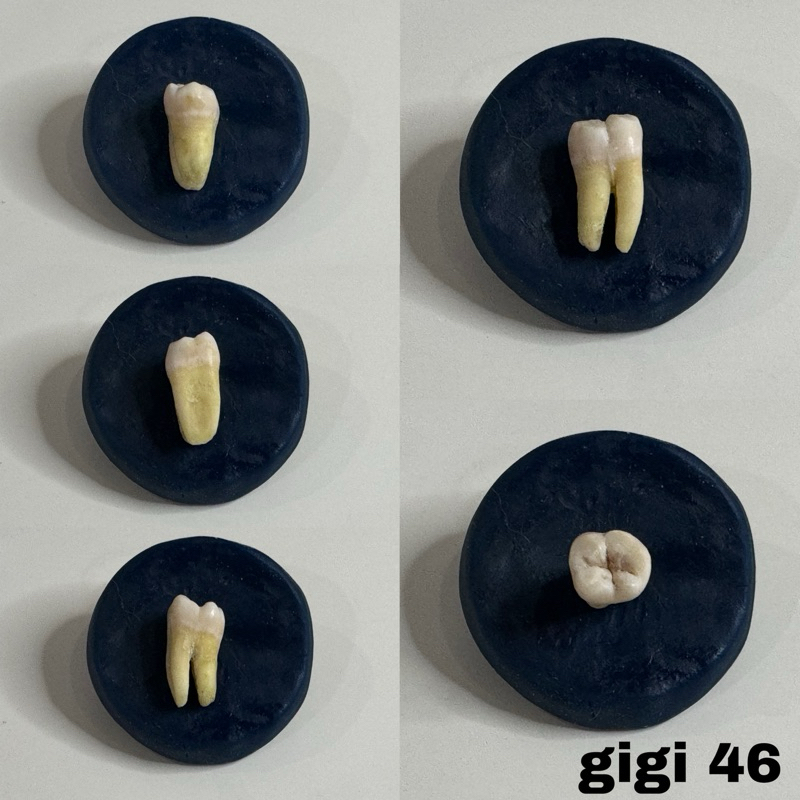 Molar 1 2 3 bawah (gigi 36 37 38 46 47 48) graham asli praktikum fkg