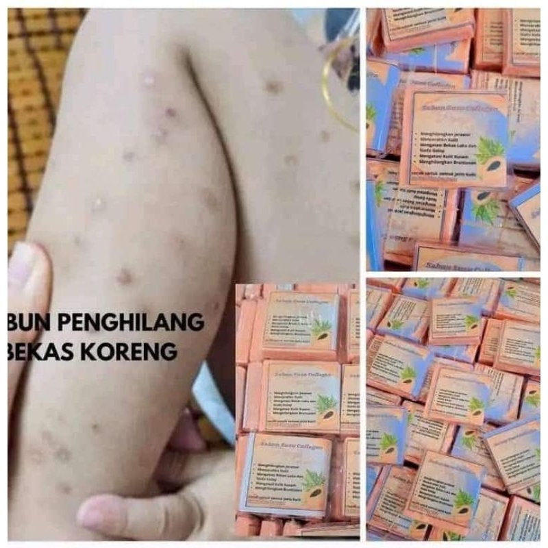 SABUN SUSU COLLAGEN PEPAYA