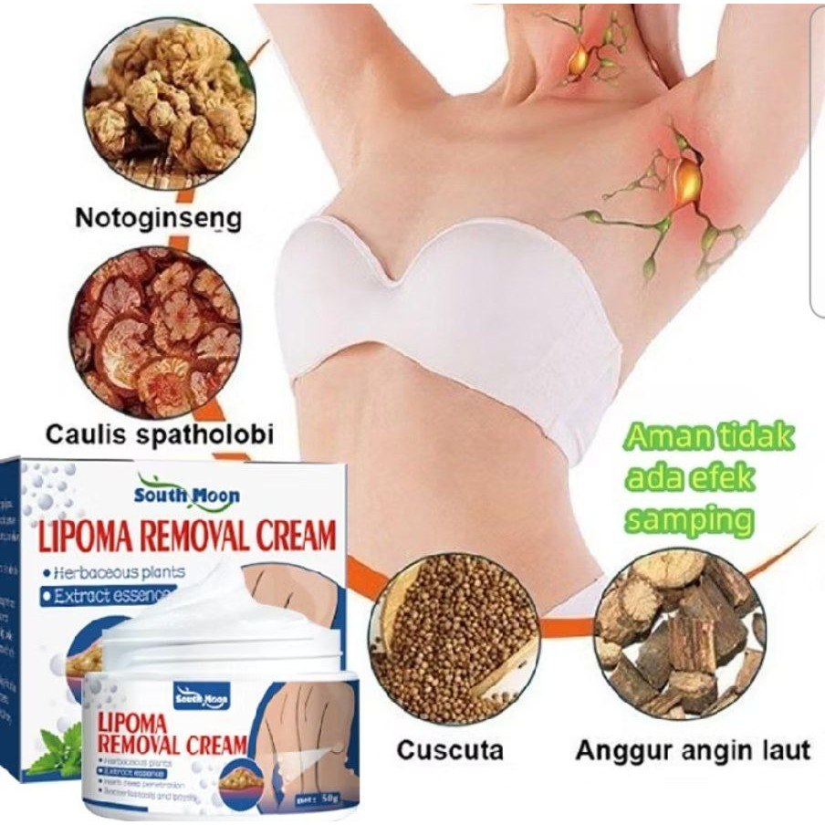 lipoma removal cream / lipoma remover krim lipoma