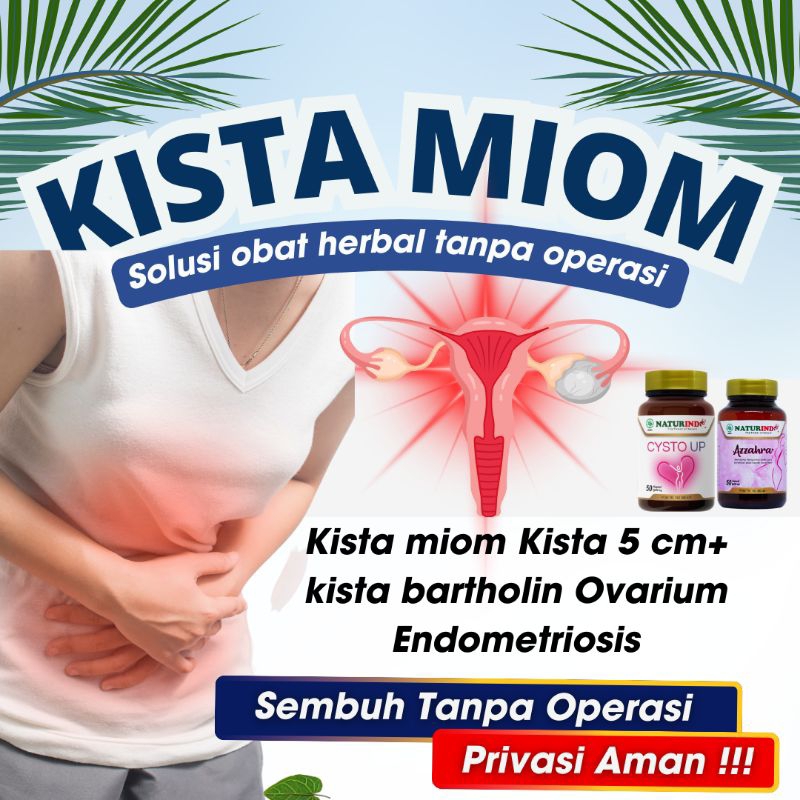 obat kista miom kista endometriosis kista Bartholin kista ovarium