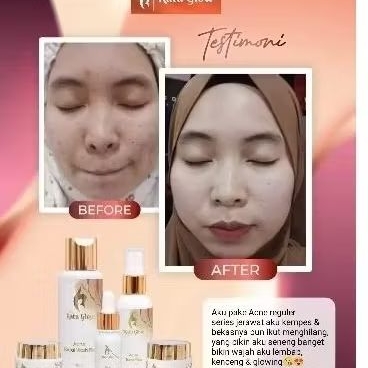 NIGHT CREAM ACNE RATU GLOW ECER /NIGHT ACNE RATU GLOW ECER/NIGHT CREAM ORIGINAL RATU GLOW