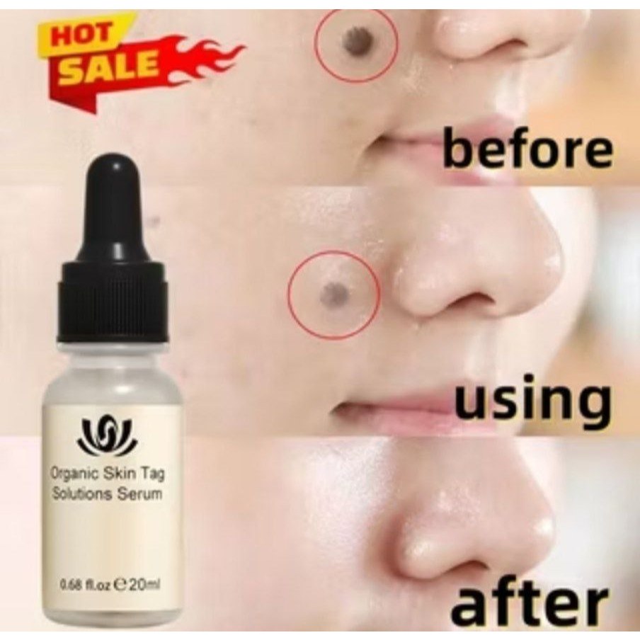 organic skin tag solutions serum