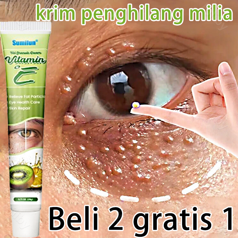 obat milia milia cream penghilang milia paling ampuh milia di wajah milia remover Untuk Semua Jenis 