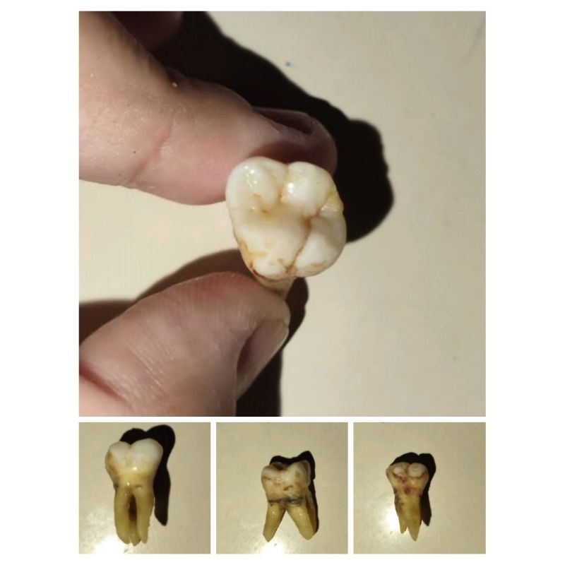 GIGI PRAKTIKUM MOLAR RAHANG ATAS/GIGI ASLI