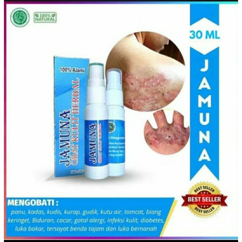 OBAT GATAL SELANGKANGAN EKSIM DAN JAMUR PALING AMPUH - OBAT GATAL KULIT - Obat Kadas Kurap Semua Jen