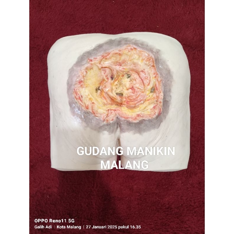PHANTOM/MANIKIN ULKUS DEKUBITUS|BOKONG/PANTAT DECUBITUS SIMULATOR|MANIKIN LUKA BARING(BEDSORES)