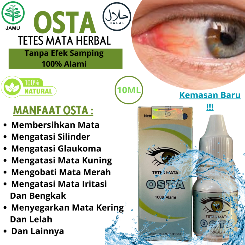 OSTA 【100% ORI】 - Tetes Mata Herbal Untuk Mengobati Semua Penyakit Mata