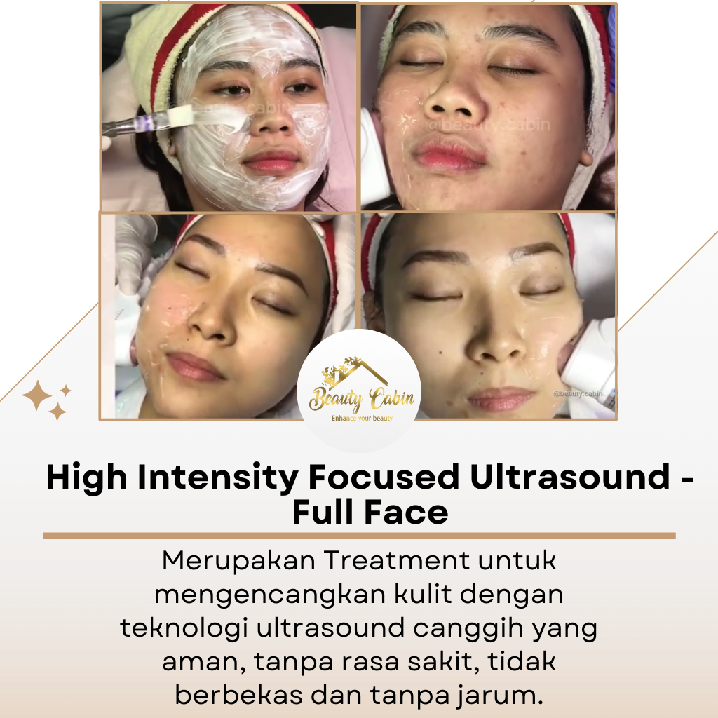 BEAUTYCABIN VOUCHER HIFU FULL FACE