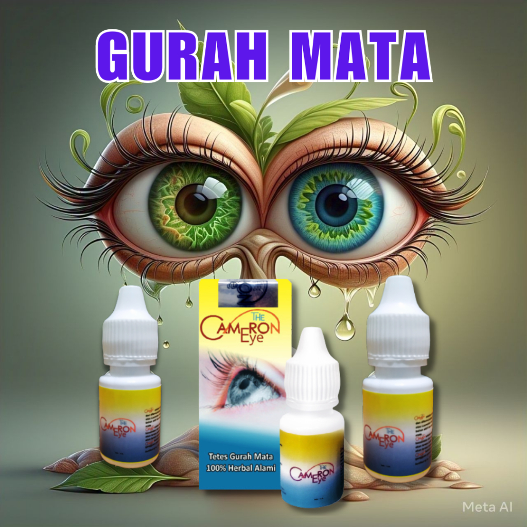 THE CAMERON EYE / TETES HERBAL JSR  / GURAH MATA NO.1 / KATARAK PLUS MINUS GLUKOMA / TERLARIS AMPUH