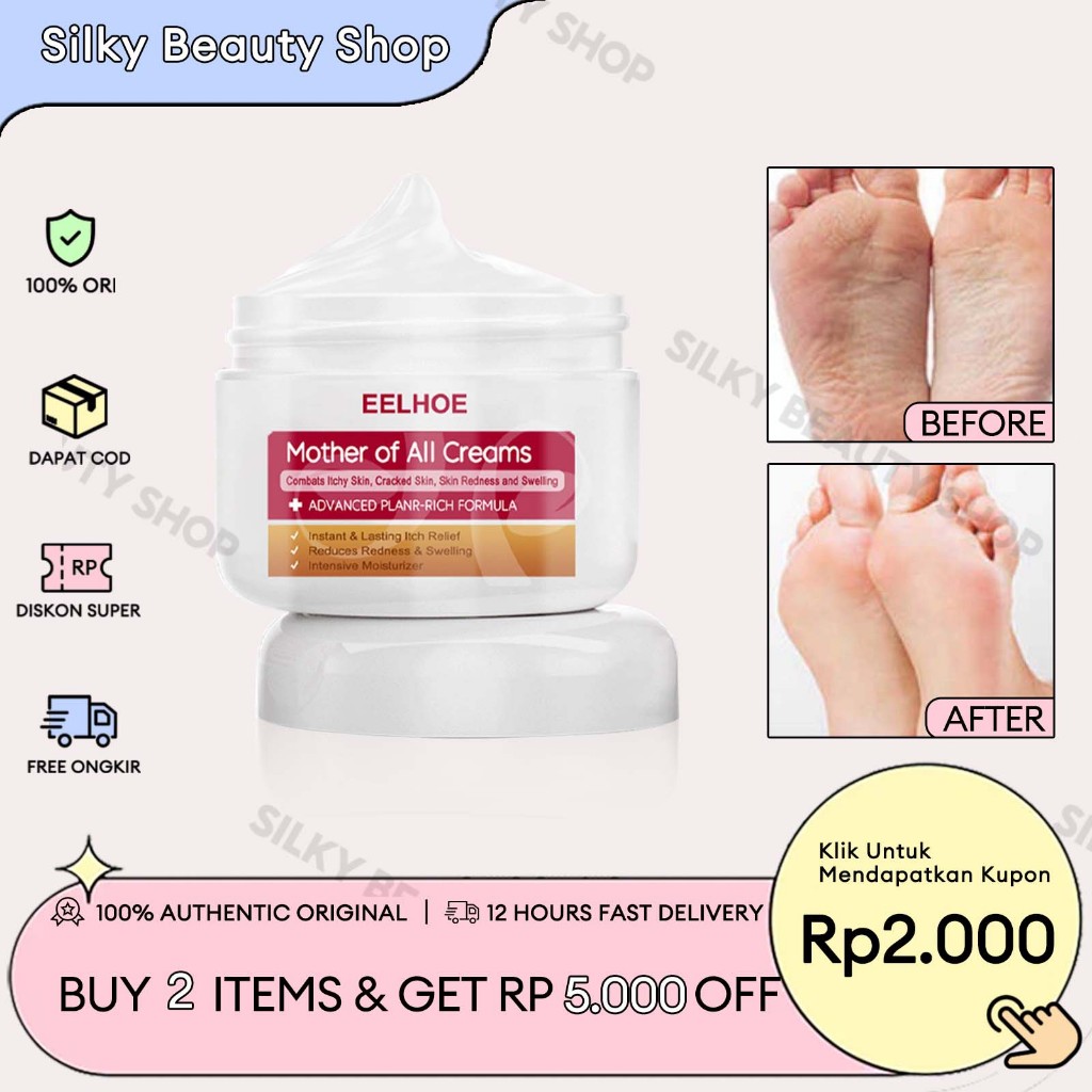 EELHOE Eczema Cream 30g Salep Gatal Paling Ampuh Obat Salep Gatal Paling Ampuh Untuk Bayi Jamur Kura