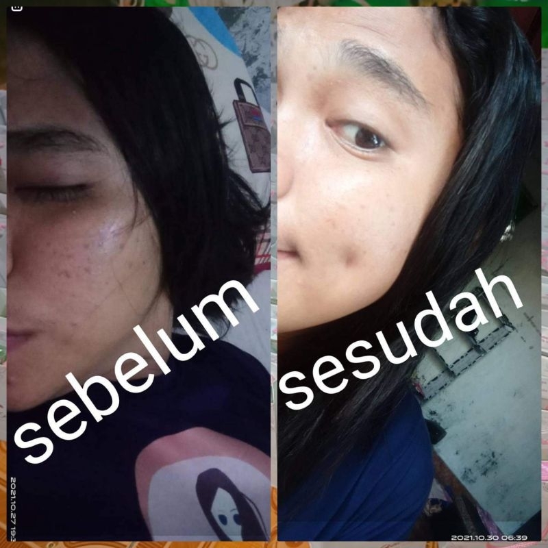 paket Cepat glow up cantika skincare Ctk skin