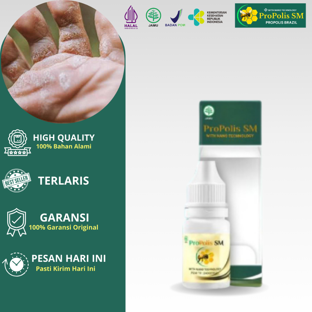 Obat kutu air & gatal jamur aman Obat Kutu Air Pada Kaki, Penghilang Kutu Air, Gatal Kaki, Jamur Kak