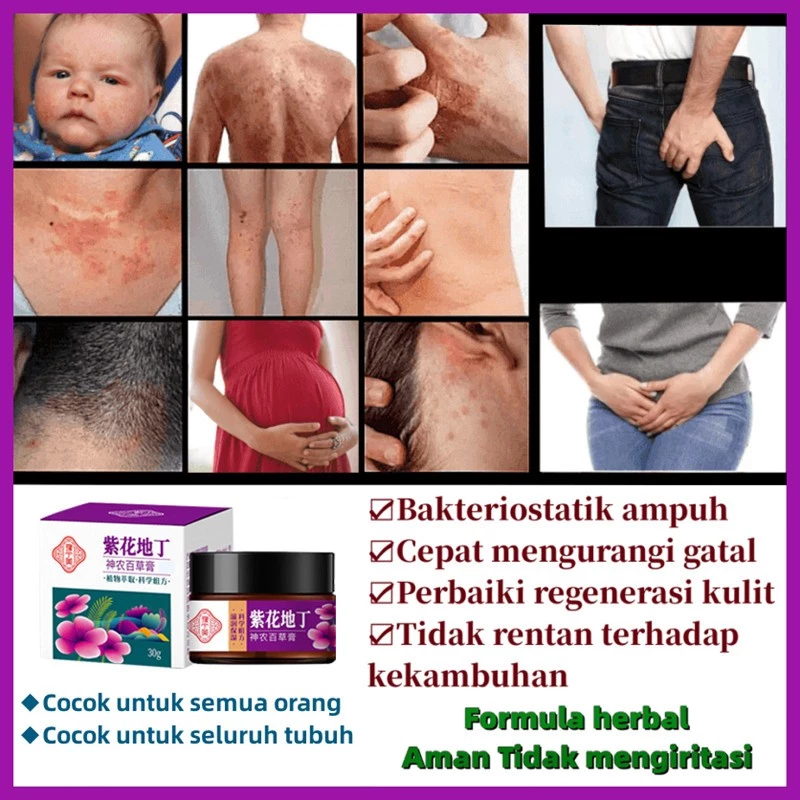 Pil antipruritik yang paling ampuh Pil pruritus yang paling ampuh Salep gatal untuk kulit Gatal di s