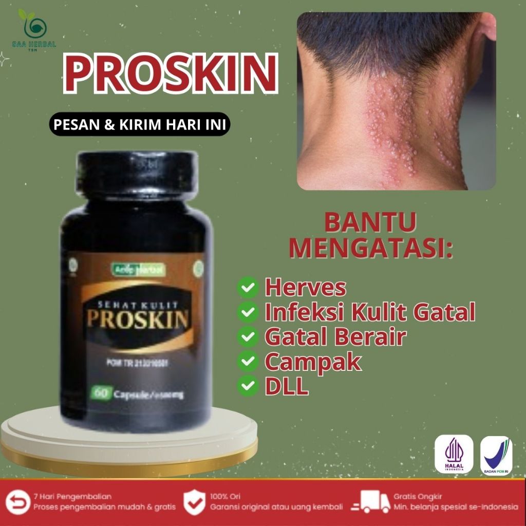 Obat Herpes, Salep herpes, penghilang herpes, Obat oles herpes bayi / anak / dewasa - 60 kapsul AMAN