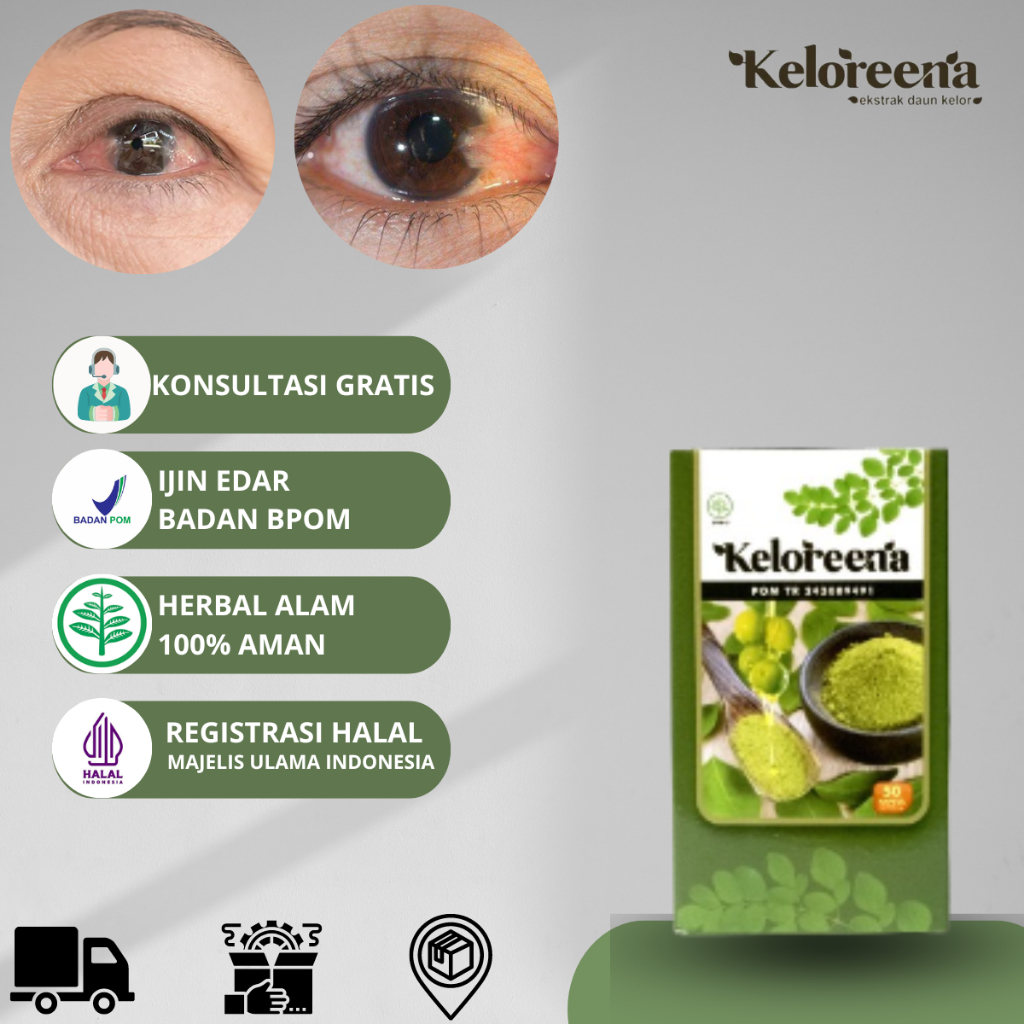 Obat Mata Pterigium Berlemak Atasi Mata Berembun Mata Berasap Penghilang Lamad Lemak Di Selaput Mata