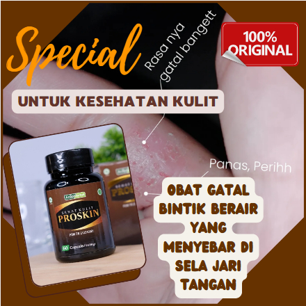 Obat Gatal Bintik Berair Yang Menyebar di Sela jari Tangan | Penghilang Eksim, Eksim Dishidrotik, Ek