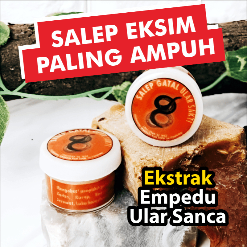 Salep Obat Gatal Kulit Eksim Kering Paling Ampuh Gatel Exim Salap Gatal Kurap Panu Kutu Air Psoriasi