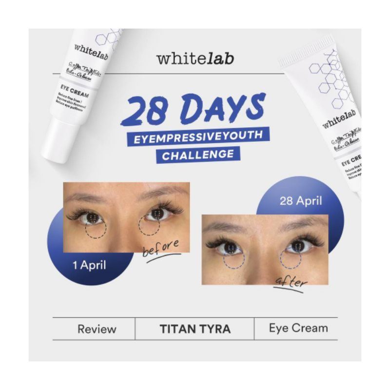 Whitelab Eye cream-krim garis bawah mata