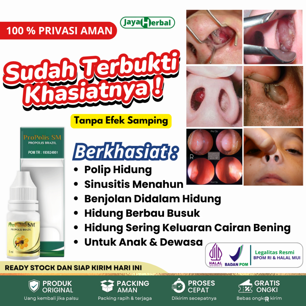 Obat Tetes Polip Hidung, Sinusitis Menahun,  Konka Hidung, Benjolan Didalam Hidung, Hidung Bau Busuk