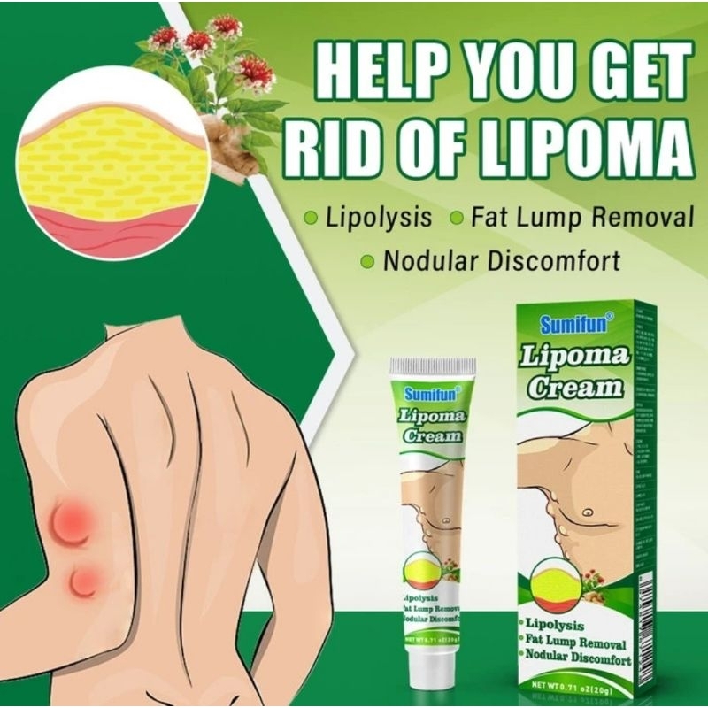 SUMIFUN Lipoma Cream - Sumifun Krim Lipoma - isi 20 gram