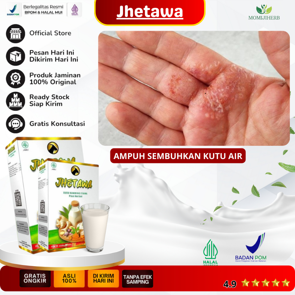 Obat Kutu Air, Gatal Kutu Air, Penghilang Kuman Air, Jamur Air, Kutu Air di Tangan, Kutu Air di Kaki