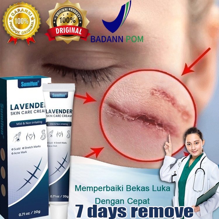 Salep penghilang bekas luka 20g Penghilang Bekas Luka Jerawat  Krim Bekas Luka Bekas Jerawat penghil