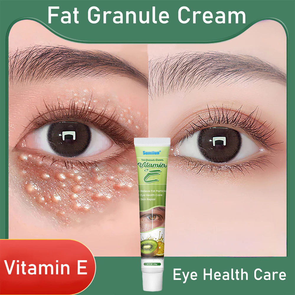 penghilang milia paling ampuh krim 20g penghilang milia syringoma xanthelasma butiran lemak sekitar