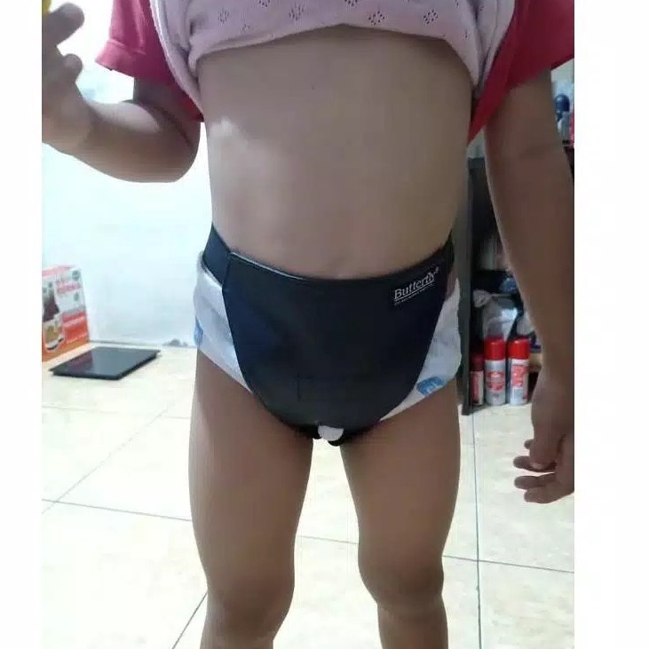 KODE P59L Celana Hernia Anak Balita Bayi Laki Perempuan