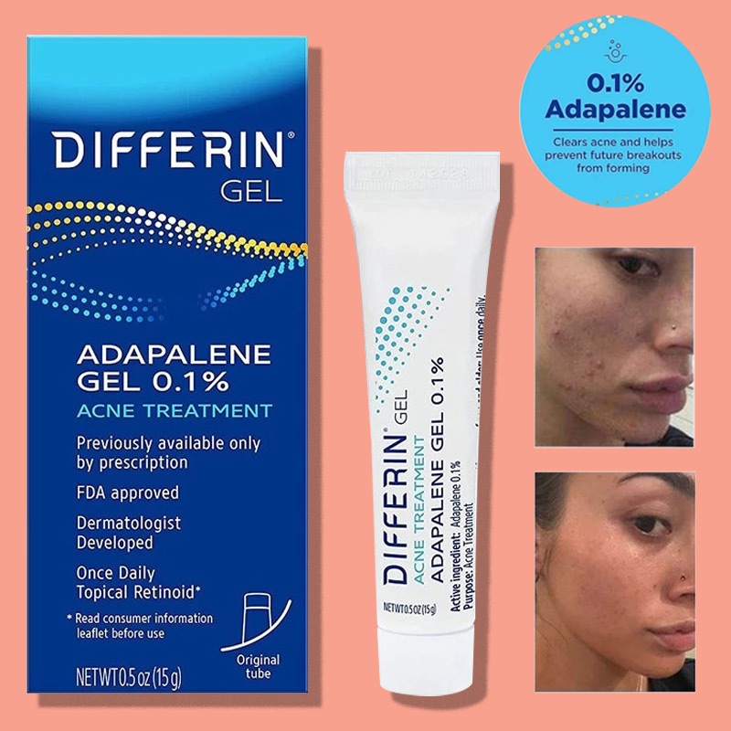 Differin Acne Treatment Gel 15 g USA / Acne Treatment / Adapalene Adapalen Gel 0.1%