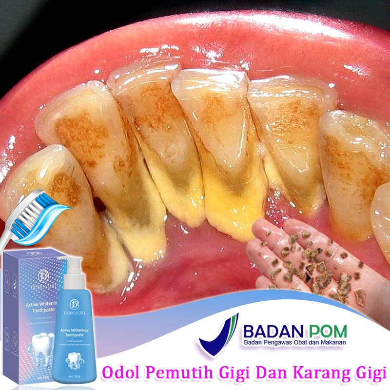 Penghilang karang gigi membandel odol pemutih gigi dan karang gigi pembersih gigi kuning dan karang