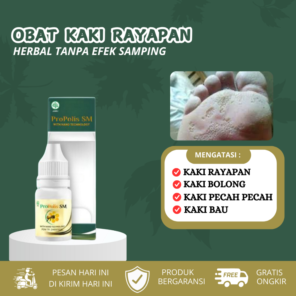 Obat Kaki Rayapan, Penghilang Rayapan, Kaki Bolong-Bolong, Rorombeheun, Korodok