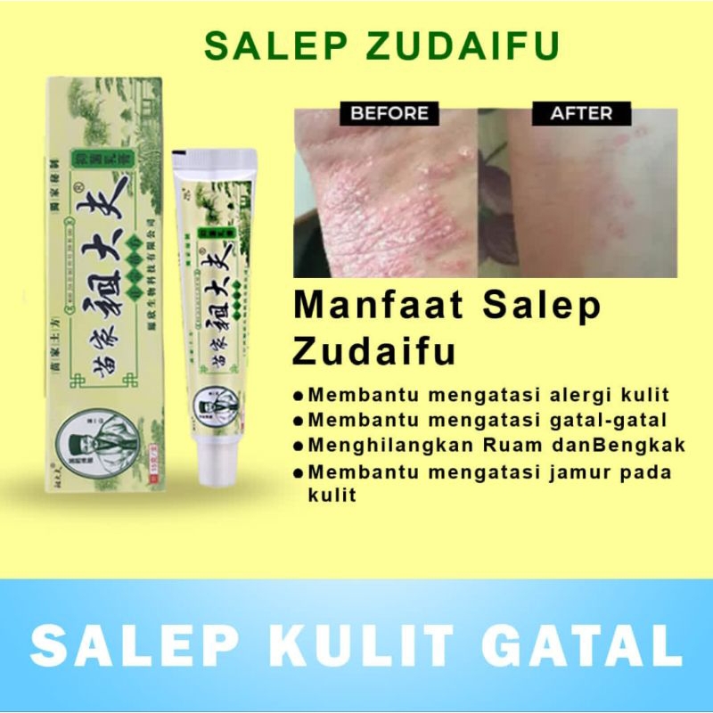 1 Box isi 20 Pcs Salep Zudaifu Grosir Zudaifu Salap Gatal