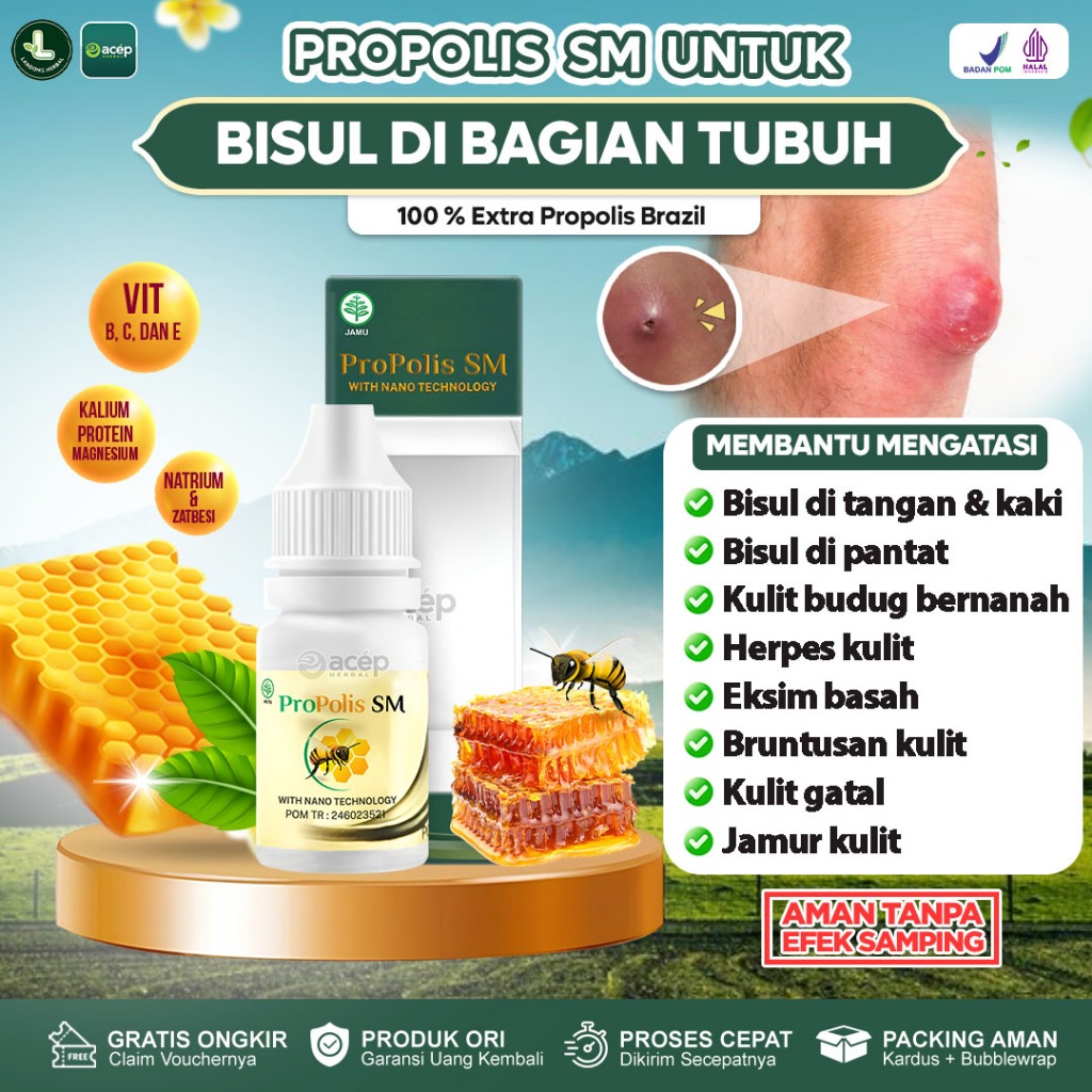 Obat Salep Bisul Di Pantat Bernanah Bisul Bengkak Di Ketiak Penghilang Benjolan Bernanah Kulit Budug