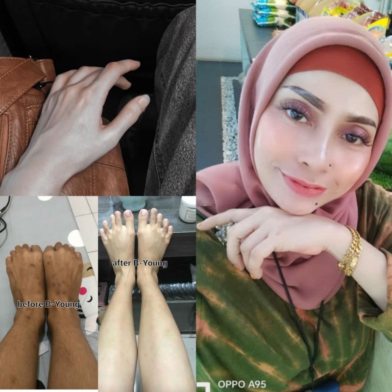 B-Young lotion Pemutih badan permanen 7x lebih cepat memutihkan ampuh lotion whitening viral
