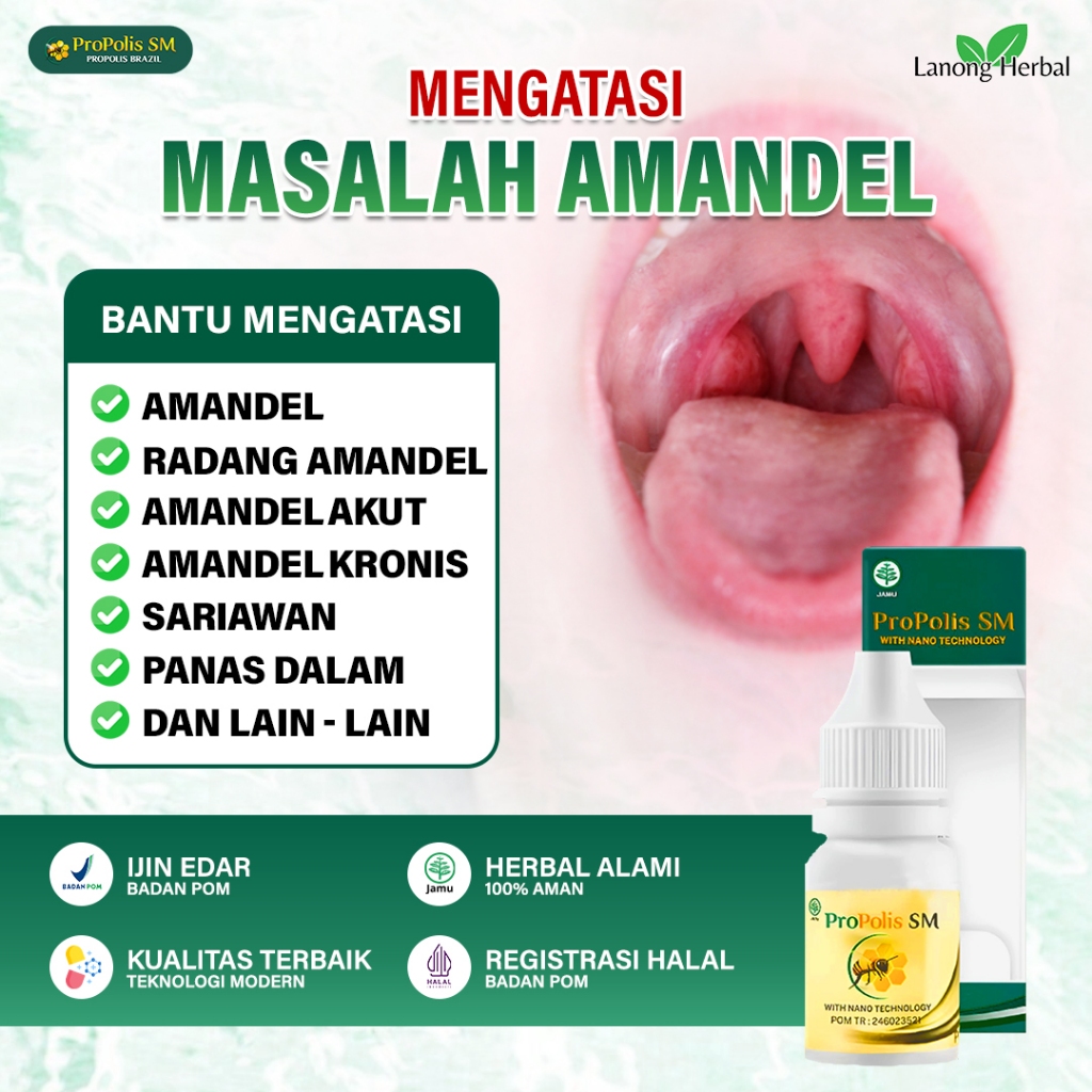 Obat Khusus Amandel Herbal Untuk Anak Dan Dewasa Pengempes Amandel Radang Tenggorokan Suara Serak PA