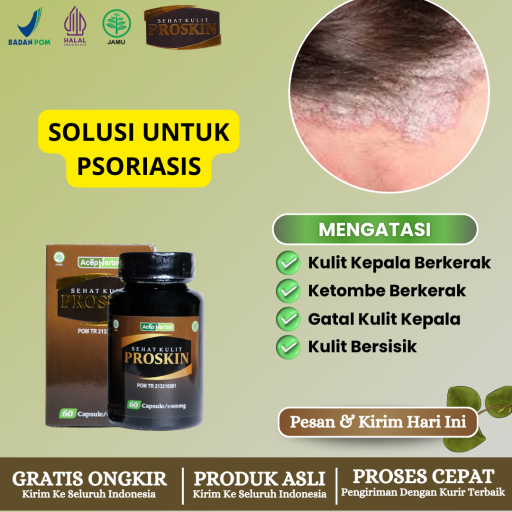 Proskin Sehat Kulit Obat Kulit Psoriasis, Kulit Bersisik, Kulit Kepala Bersisik