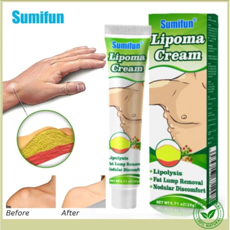 Sumifun lipoma cream original obat salep benjolan lipoma salep lipoma