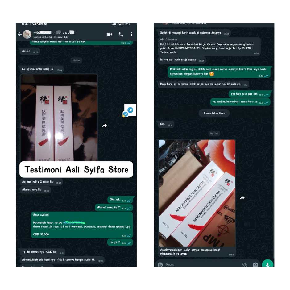 YOUBUY WHITENING AND FRECKLE REMOVING CREAM