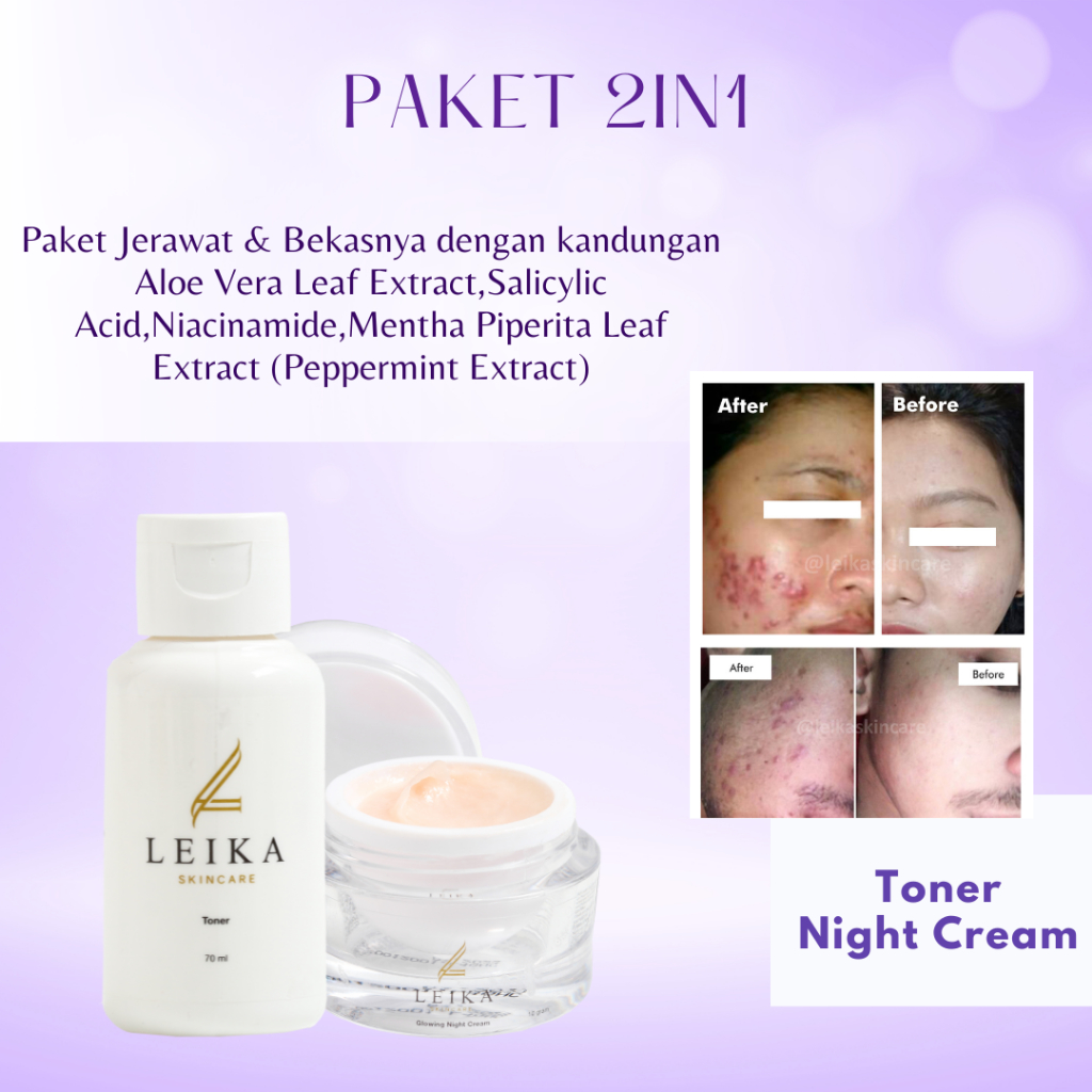 [TONER & NIGHT CREAM] Penghilang Jerawat Dan Bruntusan Penghilang Bekas Jerawat Hitam Penghilang Bop