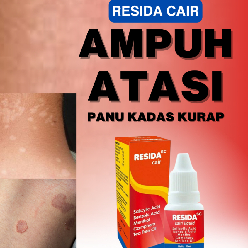 Resida Cair Original Obat Panu Gatal Kurap Jamur Kulit Eksim Paling Ampuh