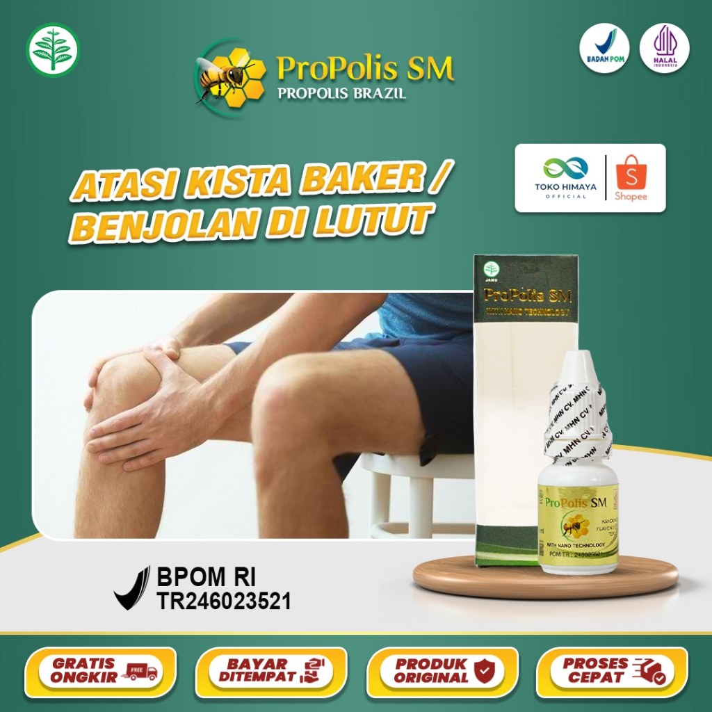 Obat Kista Baker, Benjolan Di Belakang Lutut Kanan / Kiri, Nyeri Lutut, Lutut Bengkak - Propolis SM