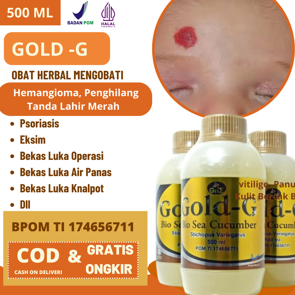 GOLD-G 【100% ORI】 | Obat Hemangioma, Penghilang Hemangioma, Penghilang Tanda Lahir Merah Aman Untuk 