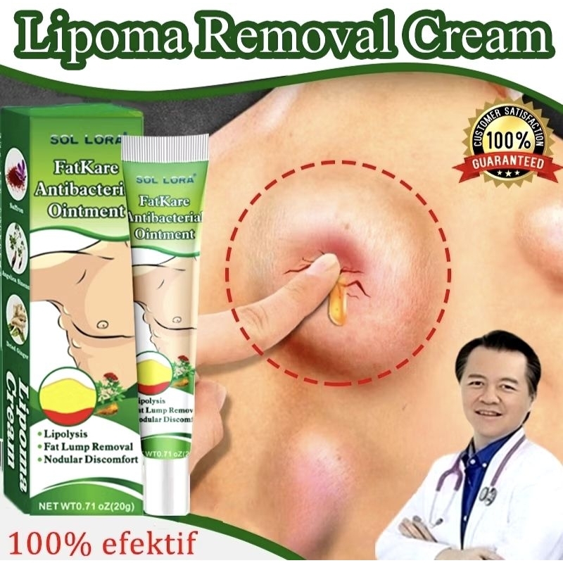 Salep lipoma original distributor langsung cream lipoma