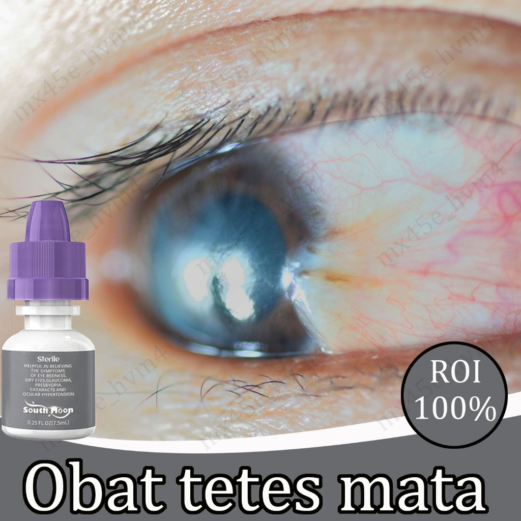 obat mata buram tetes mata obat mata katarak/mata merah/mata minus/mata kuning obat mata silinder ob